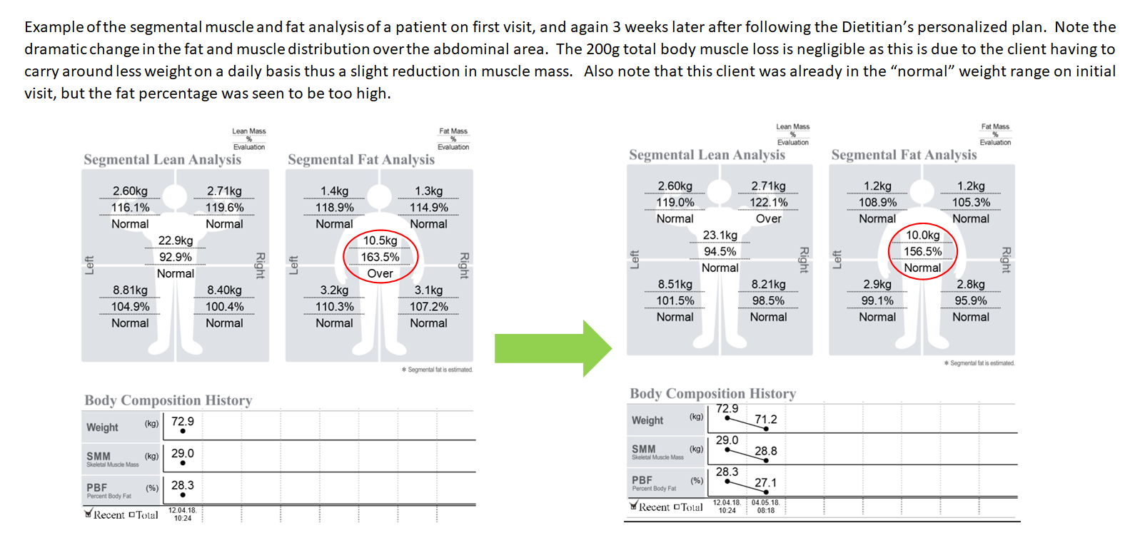 Body Composition Analysis